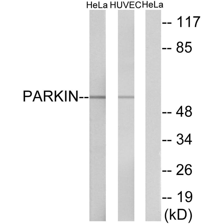 Western Blot - Anti-Parkin Antibody (B0542) - Antibodies.com