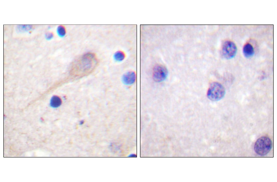 Immunohistochemistry - Anti-Parkin Antibody (B0542) - Antibodies.com