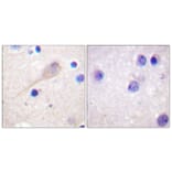 Immunohistochemistry - Anti-Parkin Antibody (B0542) - Antibodies.com