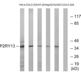 Western Blot - Anti-P2RY13 Antibody (G716) - Antibodies.com