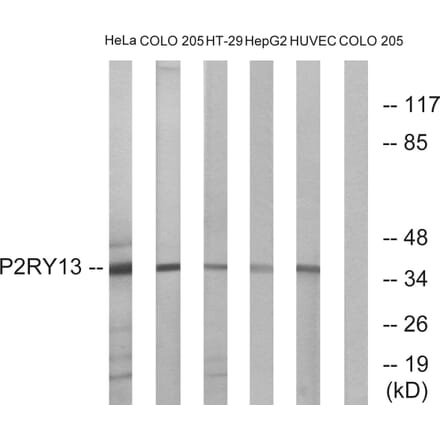 Western Blot - Anti-P2RY13 Antibody (G716) - Antibodies.com