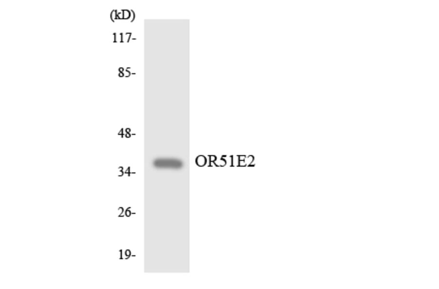 Western Blot - Anti-OR51E2 Antibody (R12-3206) - Antibodies.com