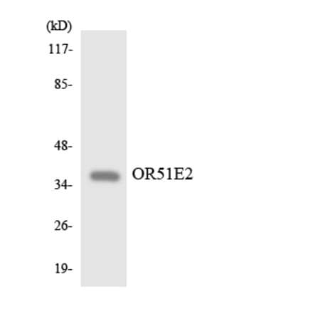 Western Blot - Anti-OR51E2 Antibody (R12-3206) - Antibodies.com