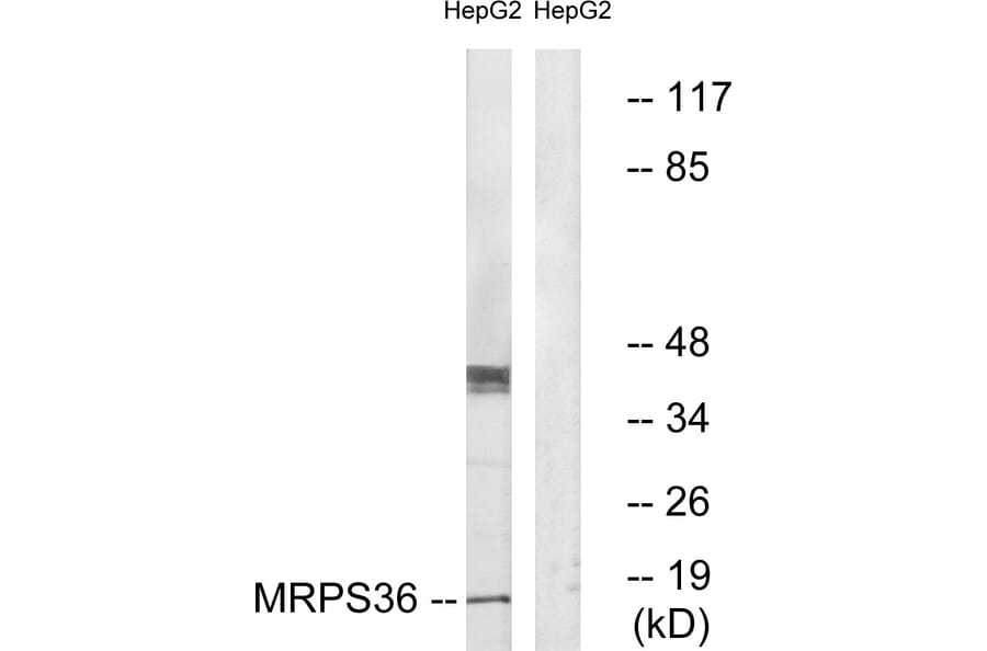 Western Blot - Anti-MRPS36 Antibody (C16663) - Antibodies.com