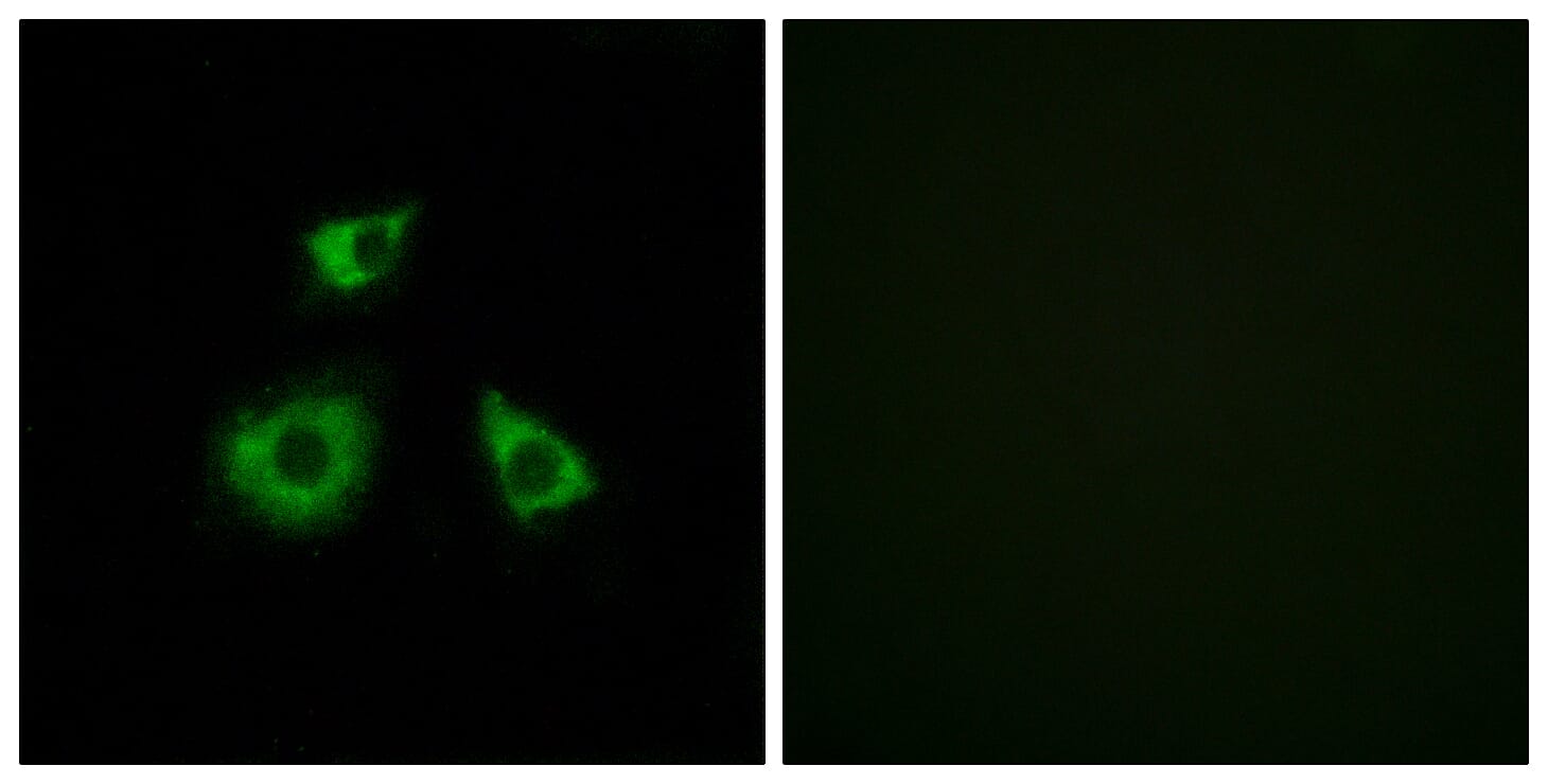 Immunofluorescence analysis of HUVEC cells using Anti-MRPL52 Antibody. The right hand panel represents a negative control, where the antibody was pre-incubated with the immunising peptide.