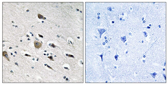 Immunohistochemical analysis of paraffin-embedded human brain tissue using Anti-MRPL52 Antibody. The right hand panel represents a negative control, where the antibody was pre-incubated with the immunising peptide.
