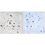 Immunohistochemistry - Anti-MRPL52 Antibody (C14086) - Antibodies.com