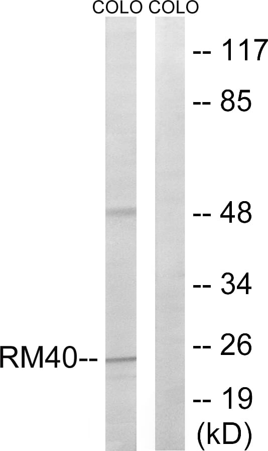 Western blot analysis of lysates from COLO cells using Anti-MRPL40 Antibody. The right hand lane represents a negative control, where the antibody is blocked by the immunising peptide.