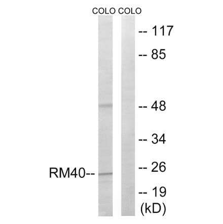 Western Blot - Anti-MRPL40 Antibody (C14077) - Antibodies.com