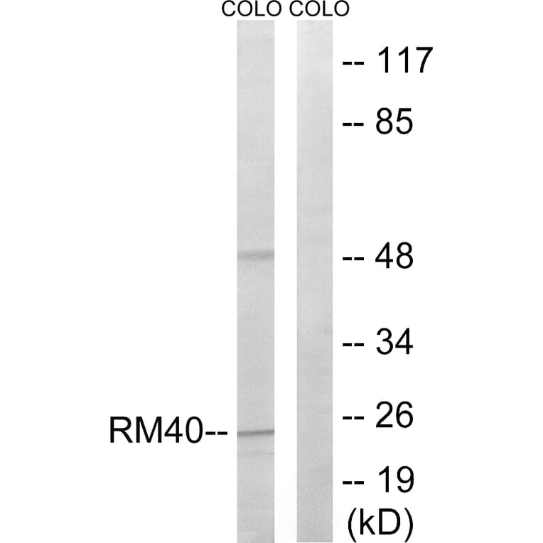 Western Blot - Anti-MRPL40 Antibody (C14077) - Antibodies.com