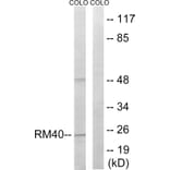 Western Blot - Anti-MRPL40 Antibody (C14077) - Antibodies.com