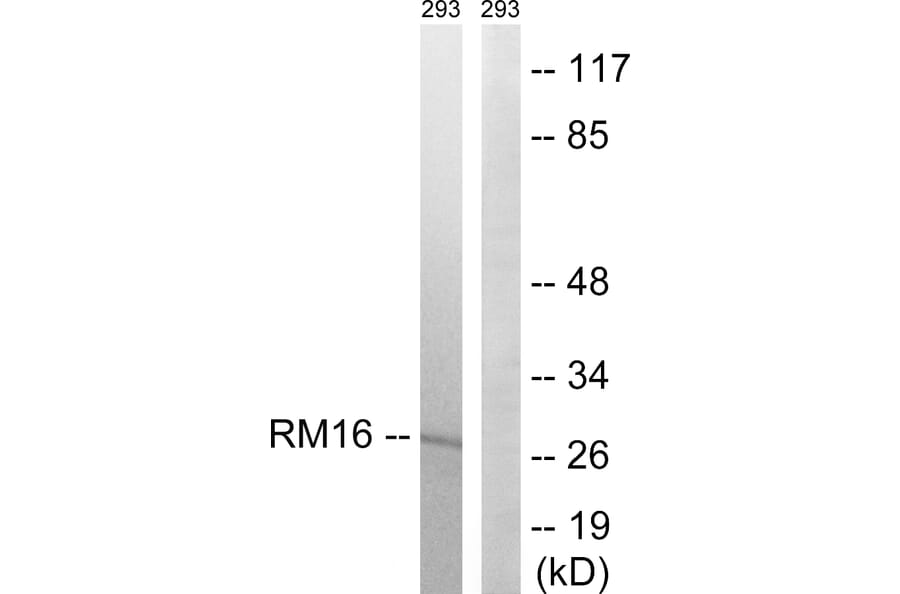 Western Blot - Anti-MRPL16 Antibody (C14060) - Antibodies.com