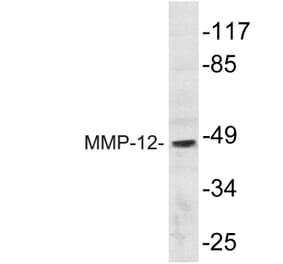Western Blot - Anti-MMP-12 Antibody (R12-2242) - Antibodies.com