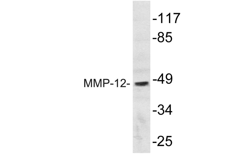 Western Blot - Anti-MMP-12 Antibody (R12-2242) - Antibodies.com