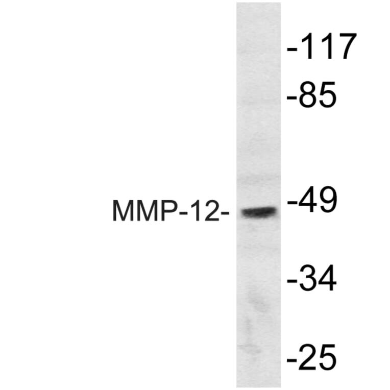 Western Blot - Anti-MMP-12 Antibody (R12-2242) - Antibodies.com