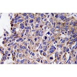 Immunohistochemistry - Anti-MMP-12 Antibody (R12-2242) - Antibodies.com