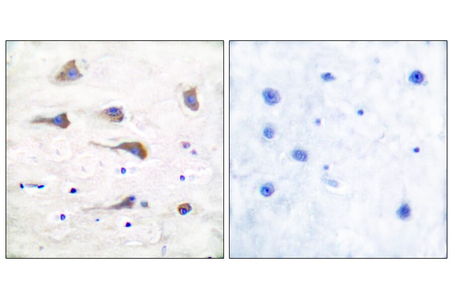 Immunohistochemistry - Anti-mGluR6 Antibody (C0210) - Antibodies.com