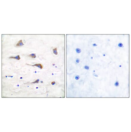 Immunohistochemistry - Anti-mGluR6 Antibody (C0210) - Antibodies.com
