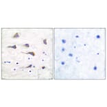 Immunohistochemistry - Anti-mGluR6 Antibody (C0210) - Antibodies.com