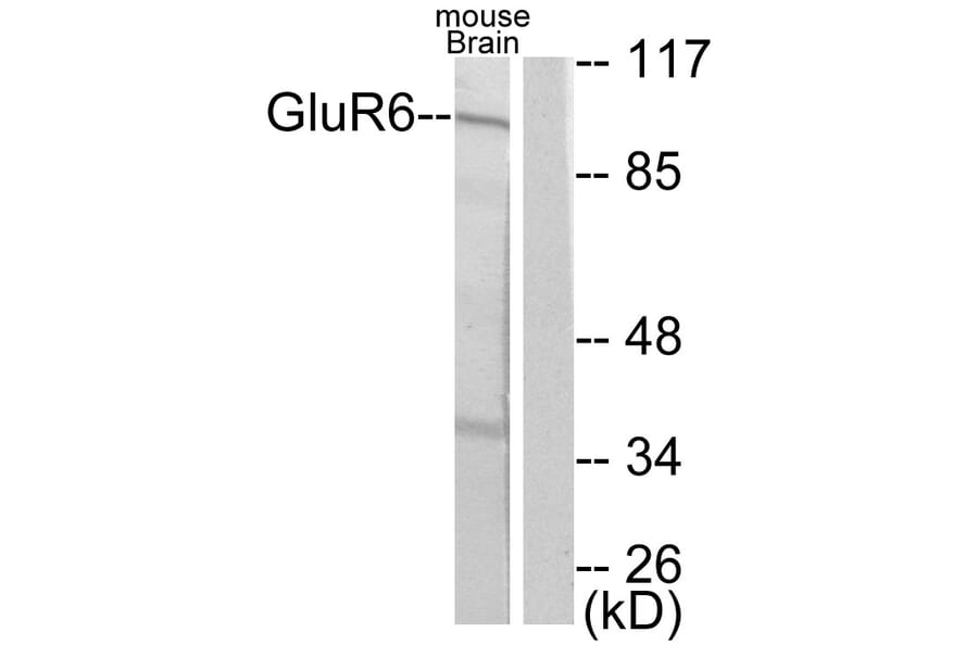 Western Blot - Anti-mGluR6 Antibody (C0210) - Antibodies.com