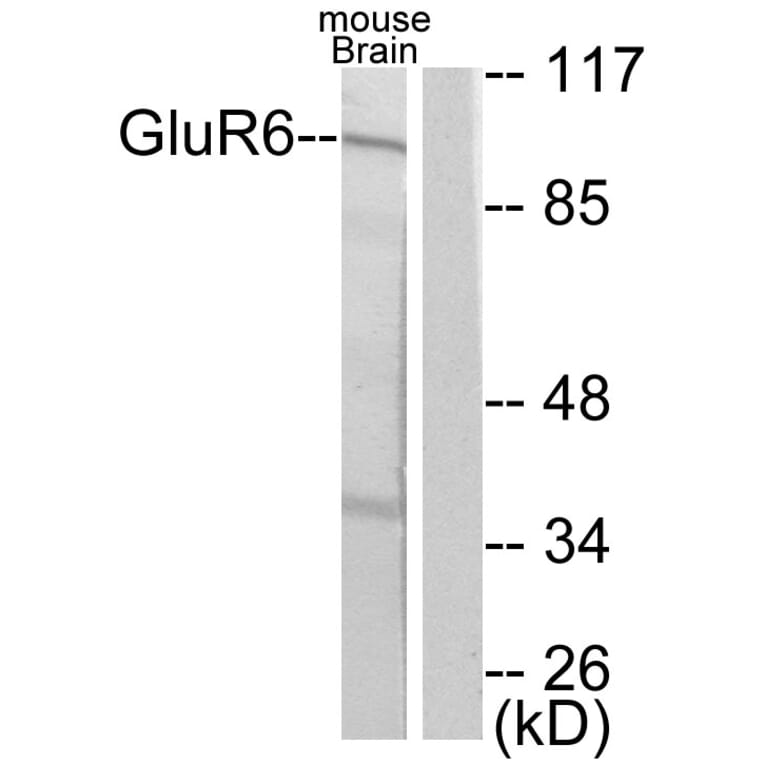 Western Blot - Anti-mGluR6 Antibody (C0210) - Antibodies.com