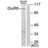 Western Blot - Anti-mGluR6 Antibody (C0210) - Antibodies.com