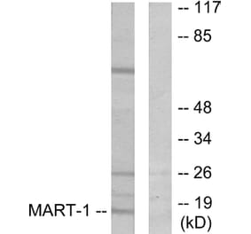 Western Blot - Anti-MART-1 Antibody (C0257) - Antibodies.com
