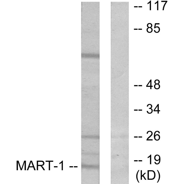 Western Blot - Anti-MART-1 Antibody (C0257) - Antibodies.com