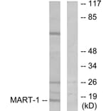 Western Blot - Anti-MART-1 Antibody (C0257) - Antibodies.com