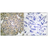 Immunohistochemistry - Anti-MART-1 Antibody (C0257) - Antibodies.com