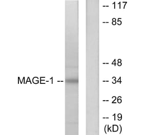 Western Blot - Anti-MAGE-1 Antibody (C0254) - Antibodies.com