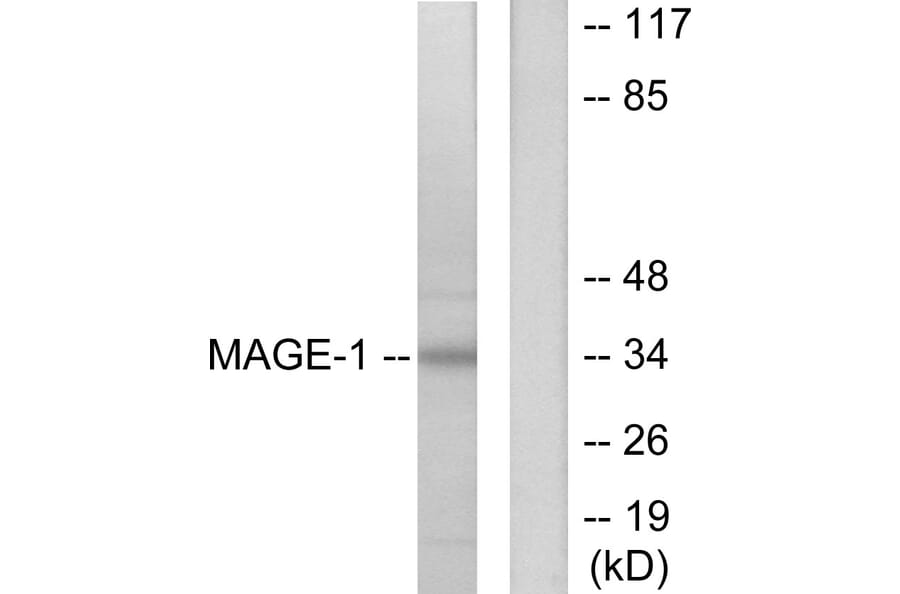 Western Blot - Anti-MAGE-1 Antibody (C0254) - Antibodies.com