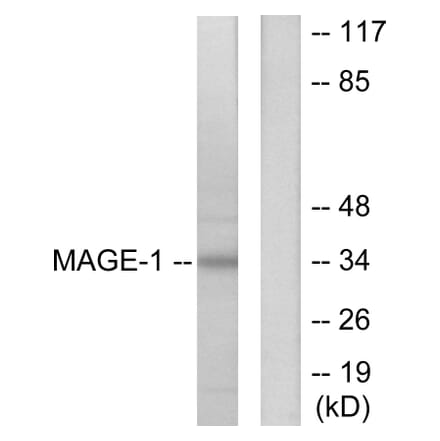 Western Blot - Anti-MAGE-1 Antibody (C0254) - Antibodies.com