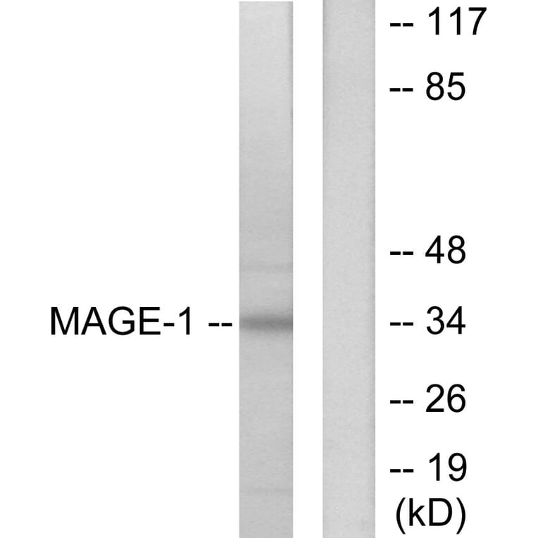 Western Blot - Anti-MAGE-1 Antibody (C0254) - Antibodies.com