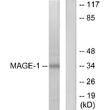 Western Blot - Anti-MAGE-1 Antibody (C0254) - Antibodies.com