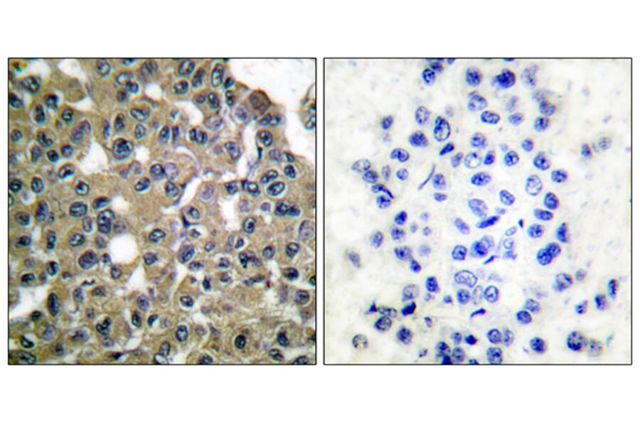Immunohistochemistry - Anti-MAGE-1 Antibody (C0254) - Antibodies.com
