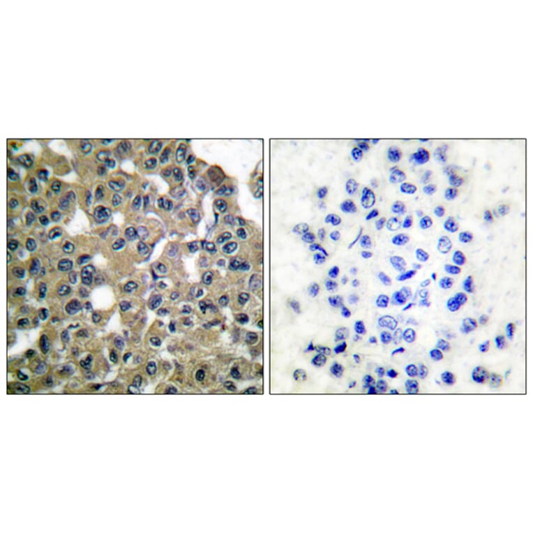 Immunohistochemistry - Anti-MAGE-1 Antibody (C0254) - Antibodies.com
