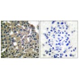 Immunohistochemistry - Anti-MAGE-1 Antibody (C0254) - Antibodies.com