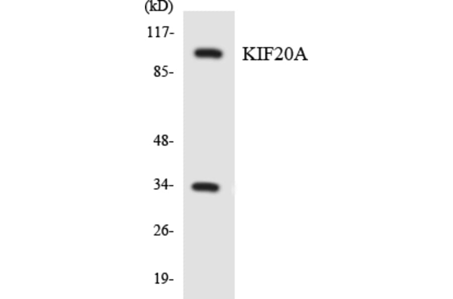 Western Blot - Anti-KIF20A Antibody (R12-2951) - Antibodies.com