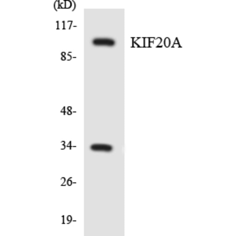 Western Blot - Anti-KIF20A Antibody (R12-2951) - Antibodies.com