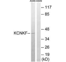 Western Blot - Anti-KCNK15 Antibody (C17778) - Antibodies.com