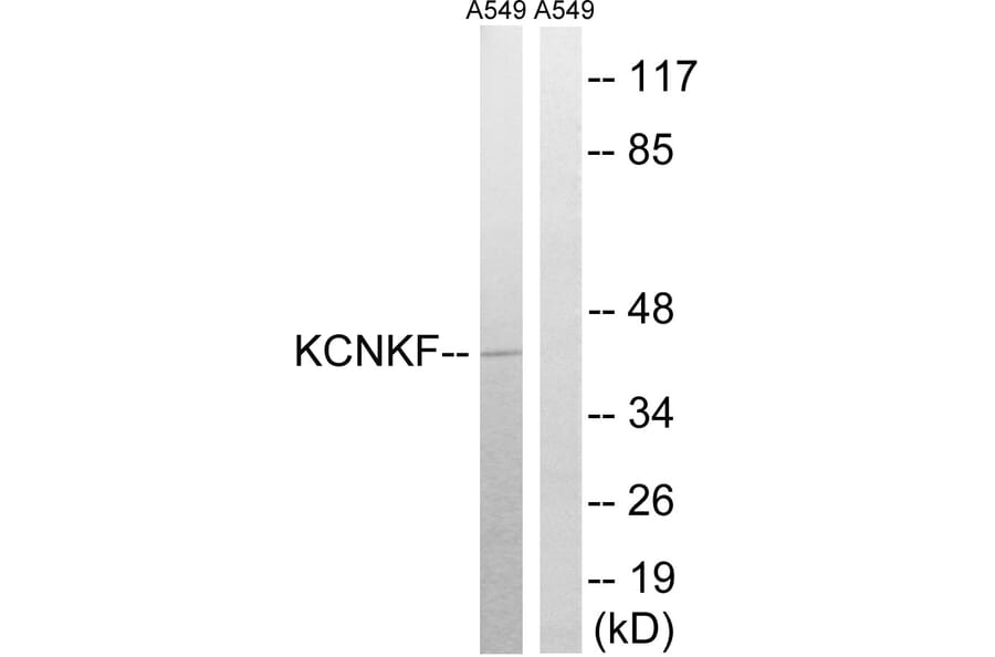 Western Blot - Anti-KCNK15 Antibody (C17778) - Antibodies.com