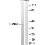 Western Blot - Anti-KCNK15 Antibody (C17778) - Antibodies.com