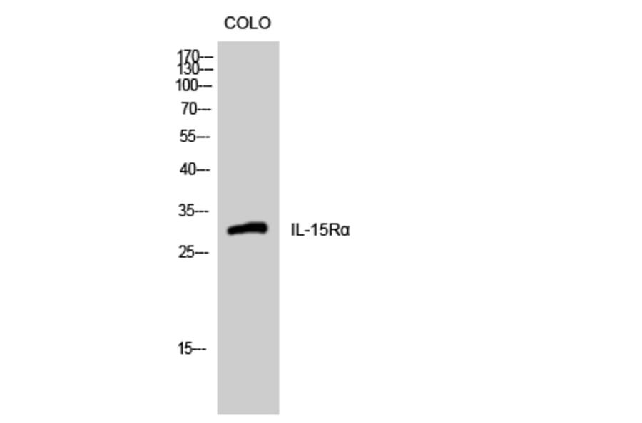 Western Blot - Anti-IL15RA Antibody (C20798) - Antibodies.com
