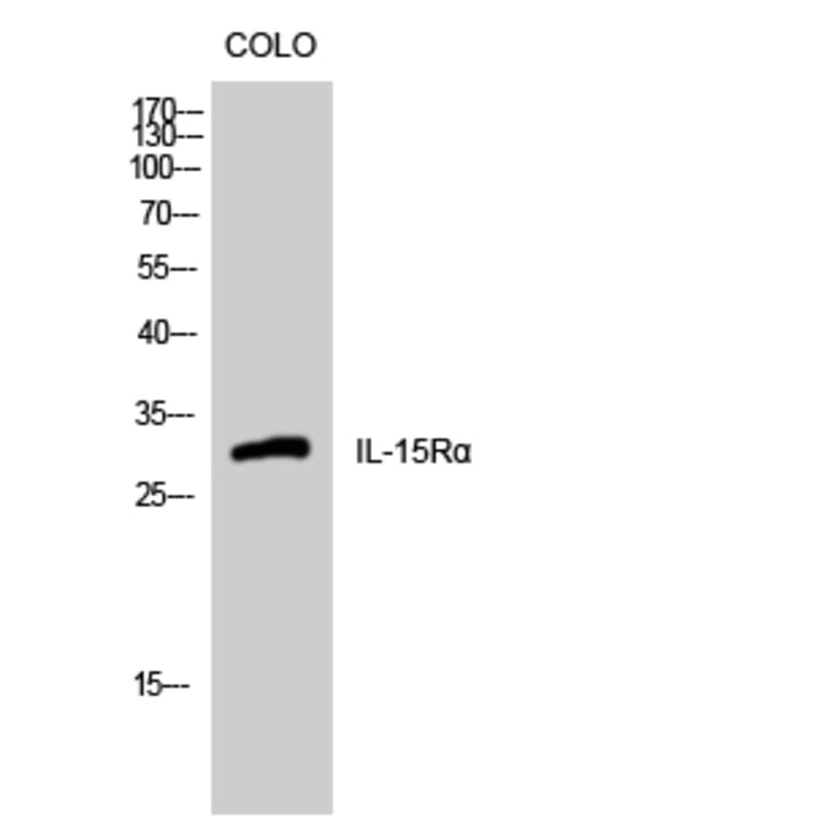 Western Blot - Anti-IL15RA Antibody (C20798) - Antibodies.com
