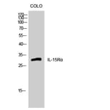 Western Blot - Anti-IL15RA Antibody (C20798) - Antibodies.com