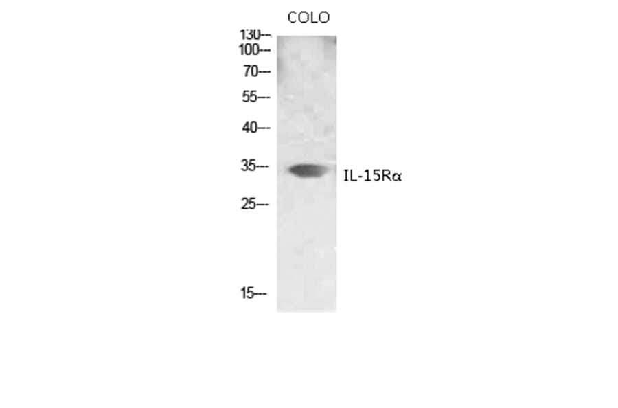 Western Blot - Anti-IL15RA Antibody (C20798) - Antibodies.com