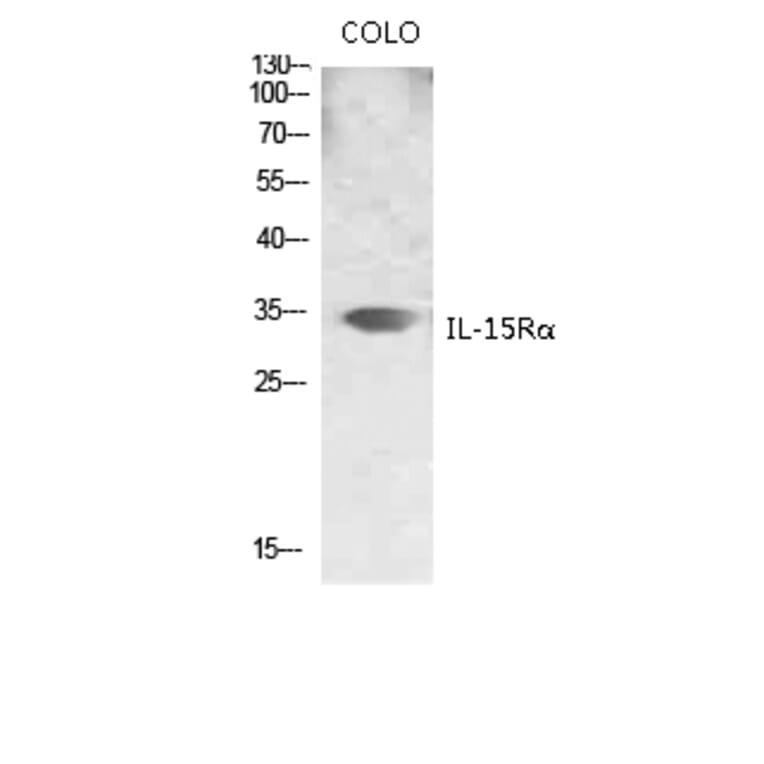 Western Blot - Anti-IL15RA Antibody (C20798) - Antibodies.com