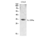 Western Blot - Anti-IL15RA Antibody (C20798) - Antibodies.com