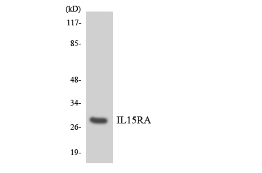 Western Blot - Anti-IL15RA Antibody (R12-2918) - Antibodies.com